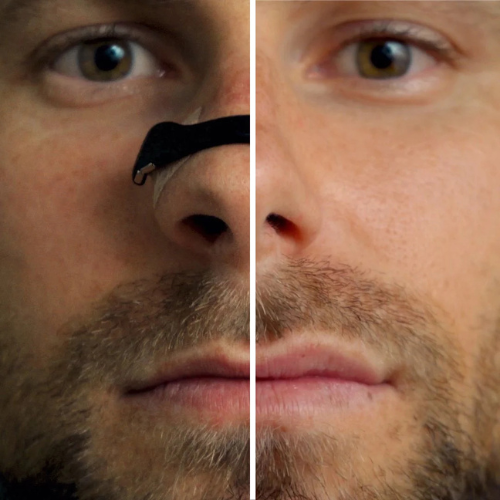 Dilatador Nasal Magnético